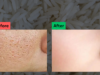 Treat Open Pores at Home with This Simple Rice Remedy