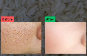 Treat Open Pores at Home with This Simple Rice Remedy
