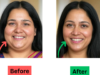 Slim Your Face Fast with This Easy and Effective Method