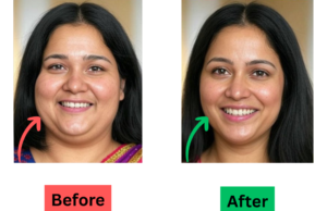 Slim Your Face Fast with This Easy and Effective Method