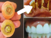 Whiten Your Teeth Instantly with This Carrot Trick