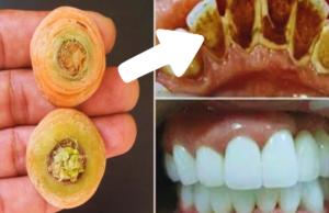 Whiten Your Teeth Instantly with This Carrot Trick