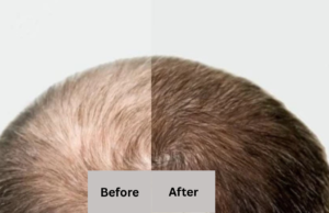 Indian Hair Growth Secret: How Cloves Can Help You Get Longer, Stronger Hair