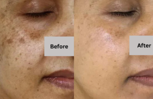 Castor Oil and Baking Soda: A Natural Remedy for Better Health