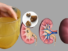 Boost Your Health: How to Naturally Cleanse Your Kidneys, Liver, and Lungs