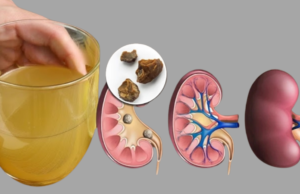 Boost Your Health: How to Naturally Cleanse Your Kidneys, Liver, and Lungs