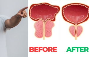 Boost Prostate Health Naturally with the Power of Onions