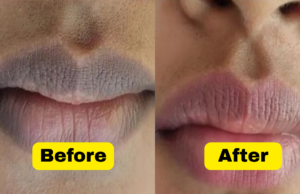 Say Goodbye to Dark Lips: Home Remedies for Lip De-Pigmentation