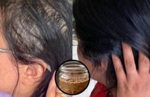 Get Longer Hair Fast: The Best Natural Treatment for Quick Growth