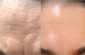 Say Goodbye to Wrinkles: The Secret to Youthful Skin