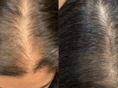 The Secret to Fast Hair Growth and No Hair Fall: Just Add These Tablets to Your Oil