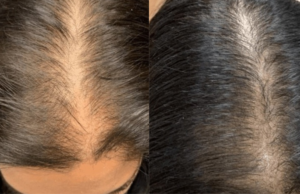 The Secret to Fast Hair Growth and No Hair Fall: Just Add These Tablets to Your Oil